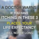 These visible signs may be hiding liver disease