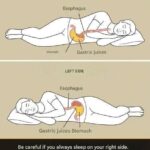 Remember that if you always sleep on your right side, you… Read more