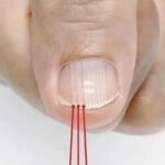 If you have these lines on your nails after 40, it is a clear sign that.