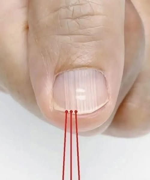 If you have these lines on your nails after 40, it is a clear sign that.
