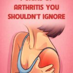 7 Signs of Arthritis You Shouldn’t Ignore