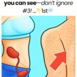 17 signs of kidney trouble you can see—don’t ignore #3!