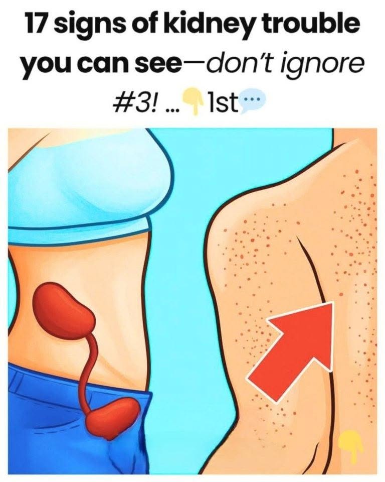 17 signs of kidney trouble you can see—don’t ignore #3!