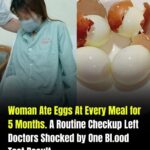 Trying to Lose Weight, She Ate Eggs at Every Meal for 5 Months. Her Medical Checkup Left Doctors Stunned