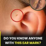 People with this ear hole have… See more