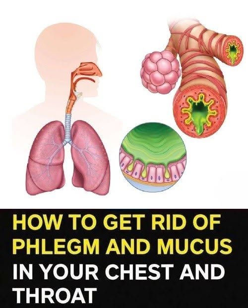 How to Get Rid of Phlegm and Mucus in Chest and Throat Naturally