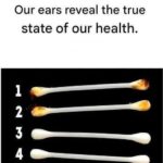 Our ears reveal the true state of our health.