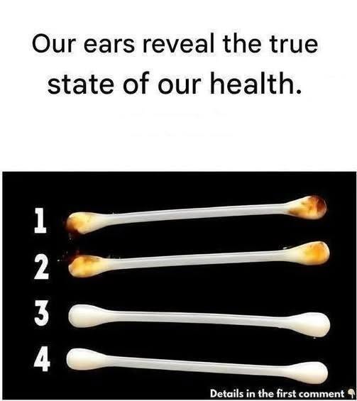 Our ears reveal the true state of our health.