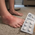 10 Often Overlooked Amlodipine Side Effects That Deserve More Attention