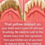 Be your own dentist! Here are some tips for removing tartar buildup at home.