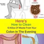 Learn How to Clean 15 Kilograms of Waste from Your Colon in One Night