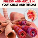 Resolving Phlegm And Mucus Problems: Best Time To Call The Doctor