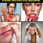 12 Worst Side Effects of Amlodipine You Should NEVER Ignore!