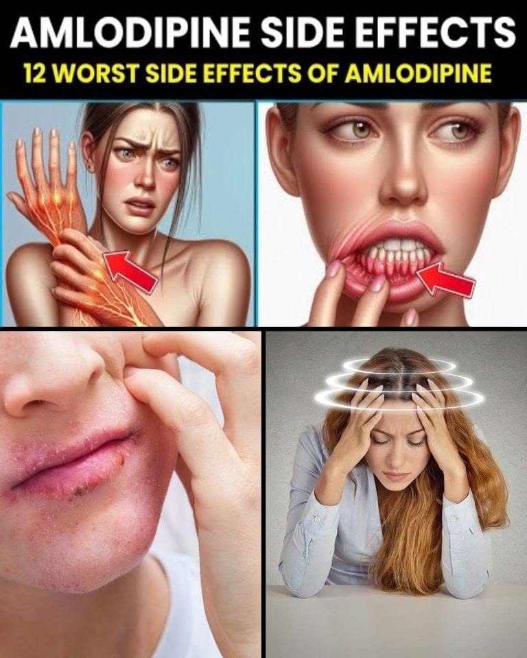 12 Worst Side Effects of Amlodipine You Should NEVER Ignore!
