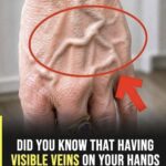 Did you know that having visible veins means you are… See more