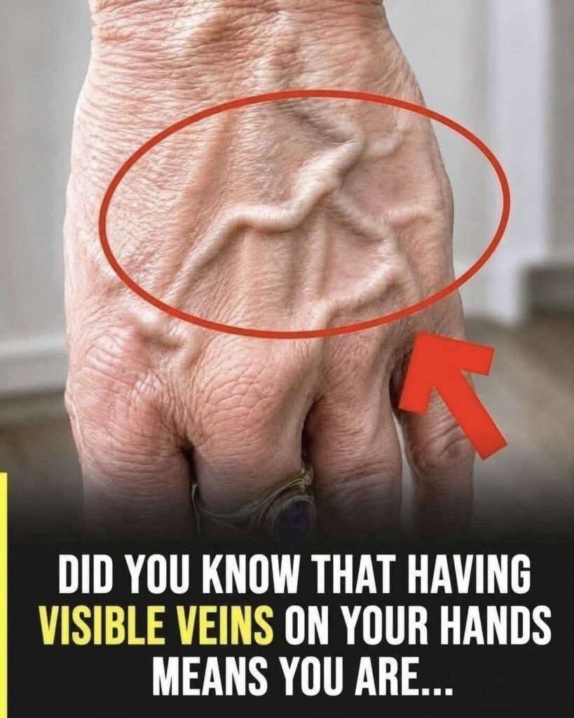 Did you know that having visible veins means you are… See more