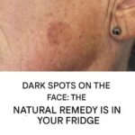 Add it to your cream and blemishes on your face will be a distant memory.