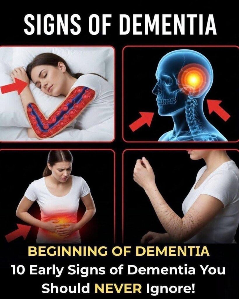 10 Early Signs of Dementia You Should NEVER Ignore