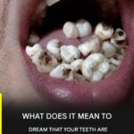 Dreaming about teeth falling out can reflect