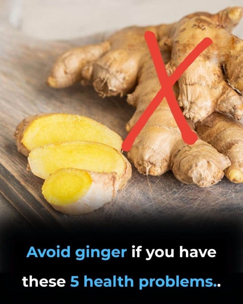 Doctors reveal that consuming ginger causes in