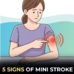 5 Signs of a Mini Stroke in the Elderly