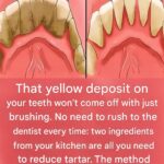 Be your own dentist! Here are some tips for removing tartar buildup at home.