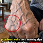 Visible Blue Veins After 60: What Your Blood Flow Is Screaming