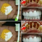 Home Teeth Whitening: Get Whiter Teeth in Just 2 Minutes!