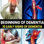 7 EARLY SIGNS of ALZHEIMER’S DISEASE that you SHOULD