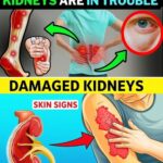 12 Early Signs of Severe Kidney Damage That Could Save Your Life