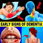 10 Early Signs of Dementia You Should NEVER Ignore!