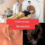 New method: colonoscopy will no longer be an invasive examination. (1/2)