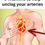 6 Vitamins to Unclog Your Arteries