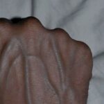 If your veins are visible in your hand, it is a signal of ca… See