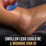 If you notice your legs are swollen, that’s a sign of ca… See more