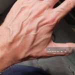 If you have visible veins, it means you are…