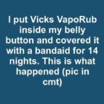 I put Vicks VapoRub inside my belly button and covered it with a bandaid for 14 nights. This is what happened.