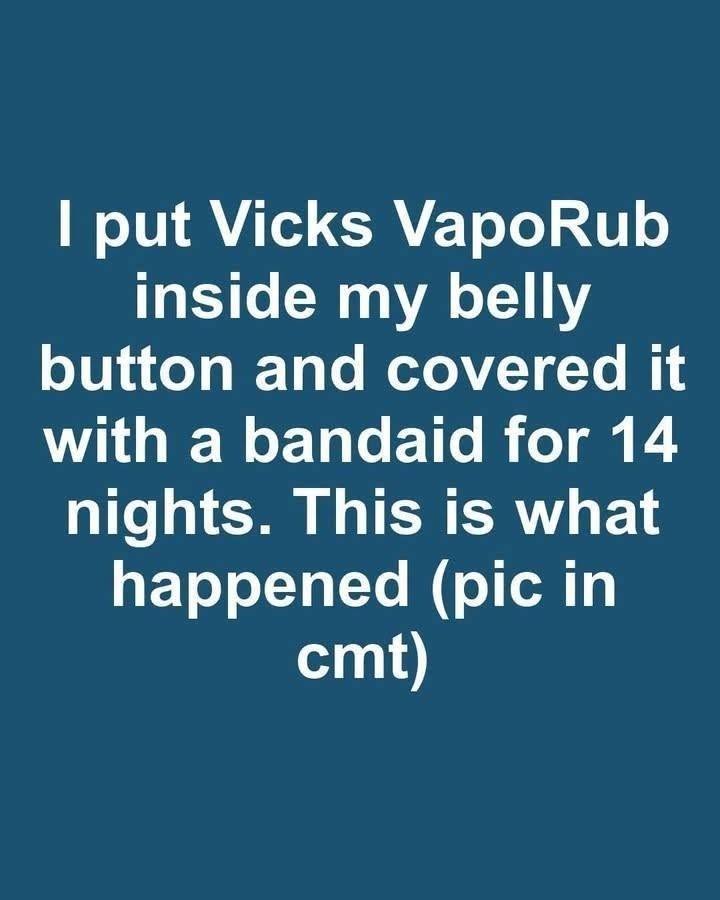 I put Vicks VapoRub inside my belly button and covered it with a bandaid for 14 nights. This is what happened.