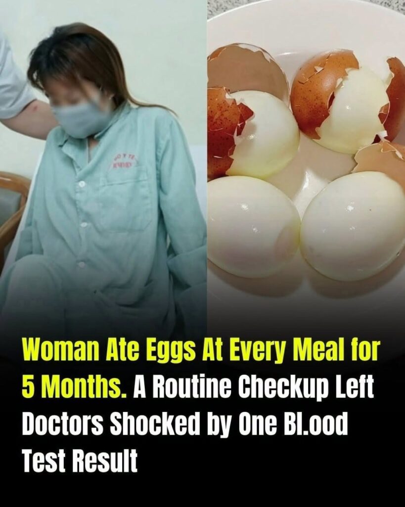 Trying to Lose Weight, She Ate Eggs at Every Meal for 5 Months. Her Medical Checkup Left Doctors Stunned
