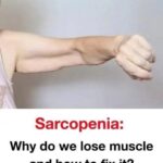 Sarcopenia: Causes of Muscle Loss and Solutions