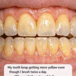 My teeth keep getting more yellow even though I brush twice a day. Why won’t they stay white?
