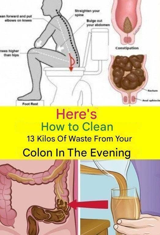 Learn How to Clean 15 Kilograms of Waste from Your Colon in One Night