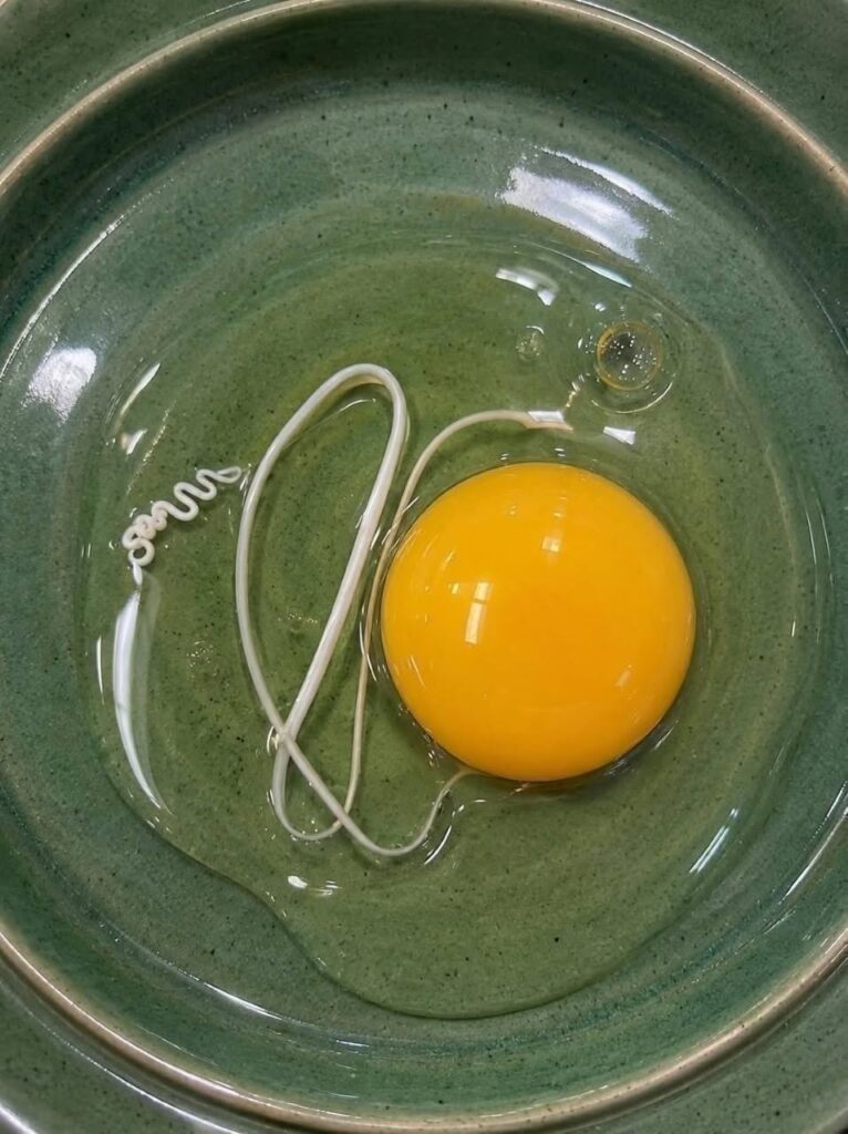 That White Ribbon in Your Egg Is Usually Completely Normal