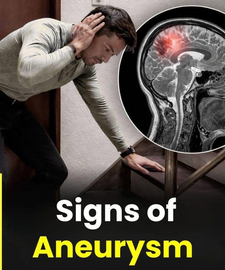 Aneurysm: 12 warning signs you absolutely should not ignore