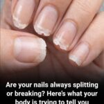 Weak or Brittle Nails: What Your Body Is Trying to Tell You