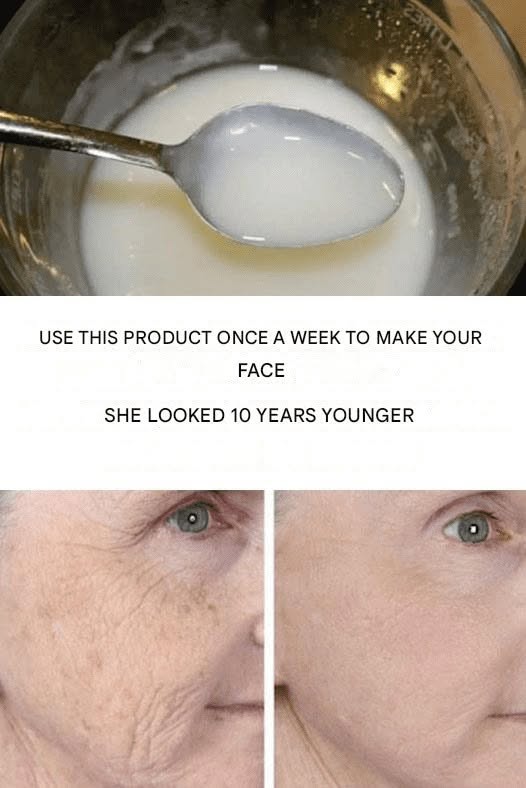 Use once a week to make your face look 10 years younger