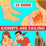 23 Strange Signs Your Kidneys Might Be in Trouble
