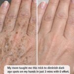 My mom taught me this trick to diminish dark age spots on my hands in just 3 mins with 0 effort. Here’s how it works