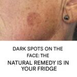 Add it to your cream and blemishes on your face will be a distant memory.