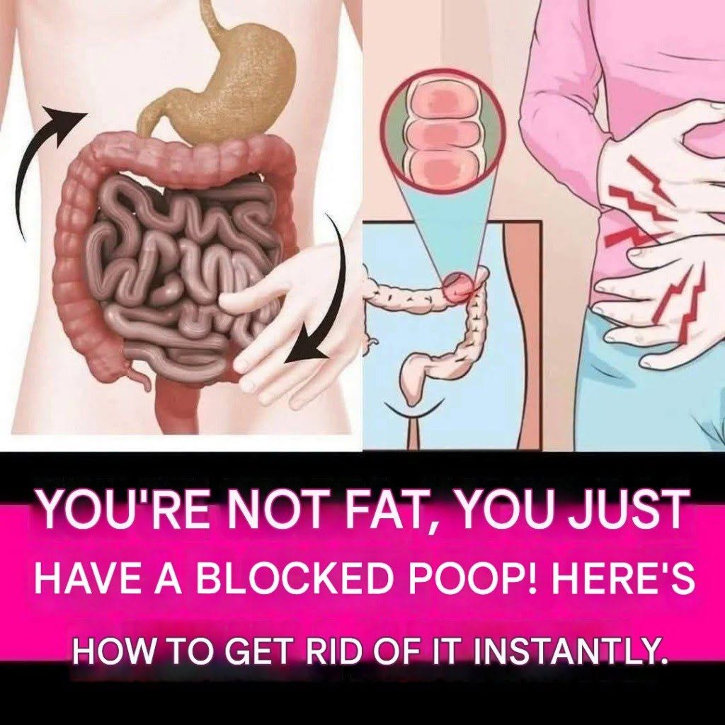 How to Eliminate Excess Stool in Your Bowel Naturally (1 / 3)